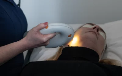 IPL (INTENSE PULSED LIGHT) SKIN REJUVENATION